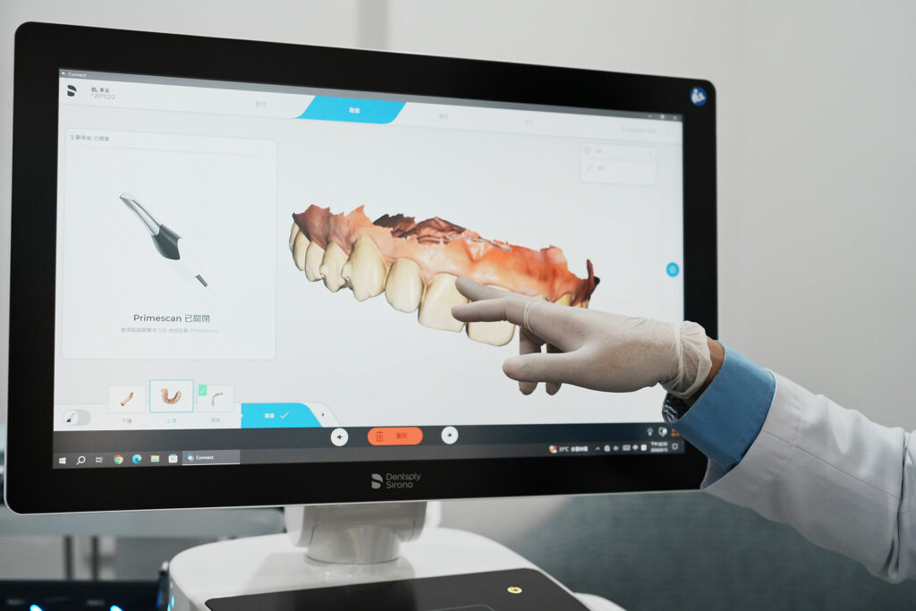 【牙拜醫師吳冠儒｜台中美齒貼片與微笑設計推薦】全瓷貼片講解照片