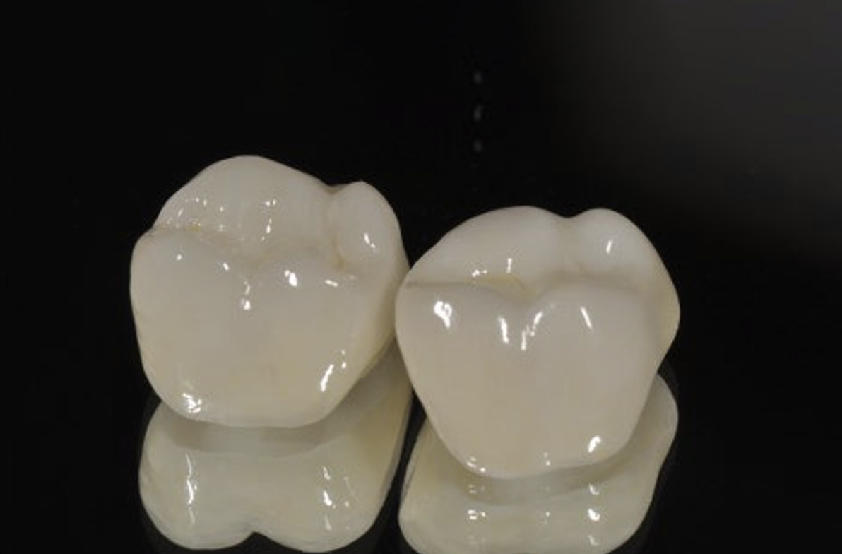 【牙拜醫師：美齒案例】前後對比