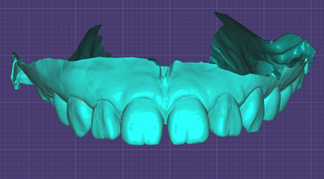【牙拜醫師：牙齒貼片價格大公開！陶瓷貼片、樹脂貼片優缺點解析】牙齒示意圖