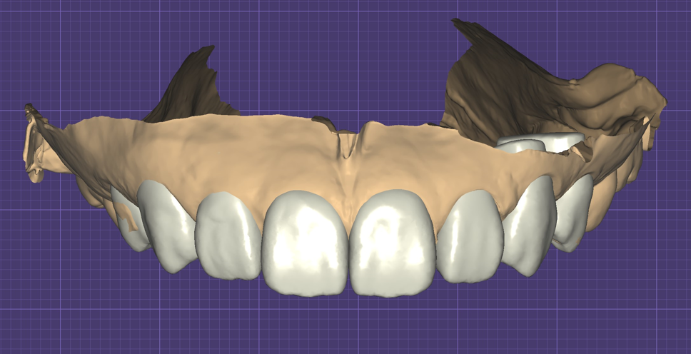 【牙拜醫師：牙齒貼片價格大公開！陶瓷貼片、樹脂貼片優缺點解析】牙齒示意圖