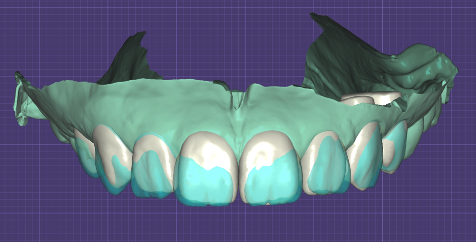 【牙拜醫師：牙齒貼片價格大公開！陶瓷貼片、樹脂貼片優缺點解析】牙齒示意圖