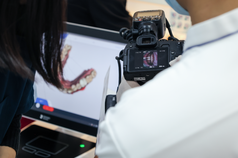 牙拜醫師：牙齒貼片價格大公開！陶瓷貼片、樹脂貼片優缺點解析