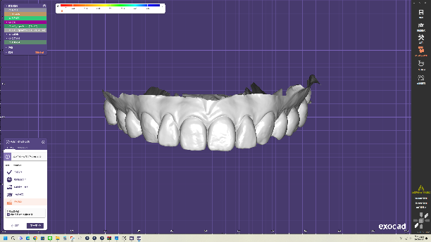 【牙拜醫師衛教小知識：為什麼牙齒顏色會變黑或變黃？】牙齒示意圖