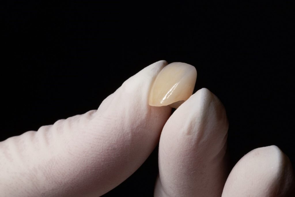 【牙拜醫師衛教小知識：為什麼牙齒顏色會變黑或變黃？】情境圖