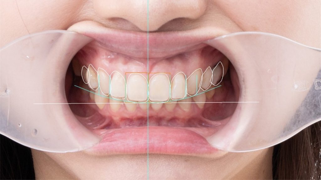 【牙拜醫師衛教小知識：為什麼牙齒顏色會變黑或變黃？】牙齒示意圖